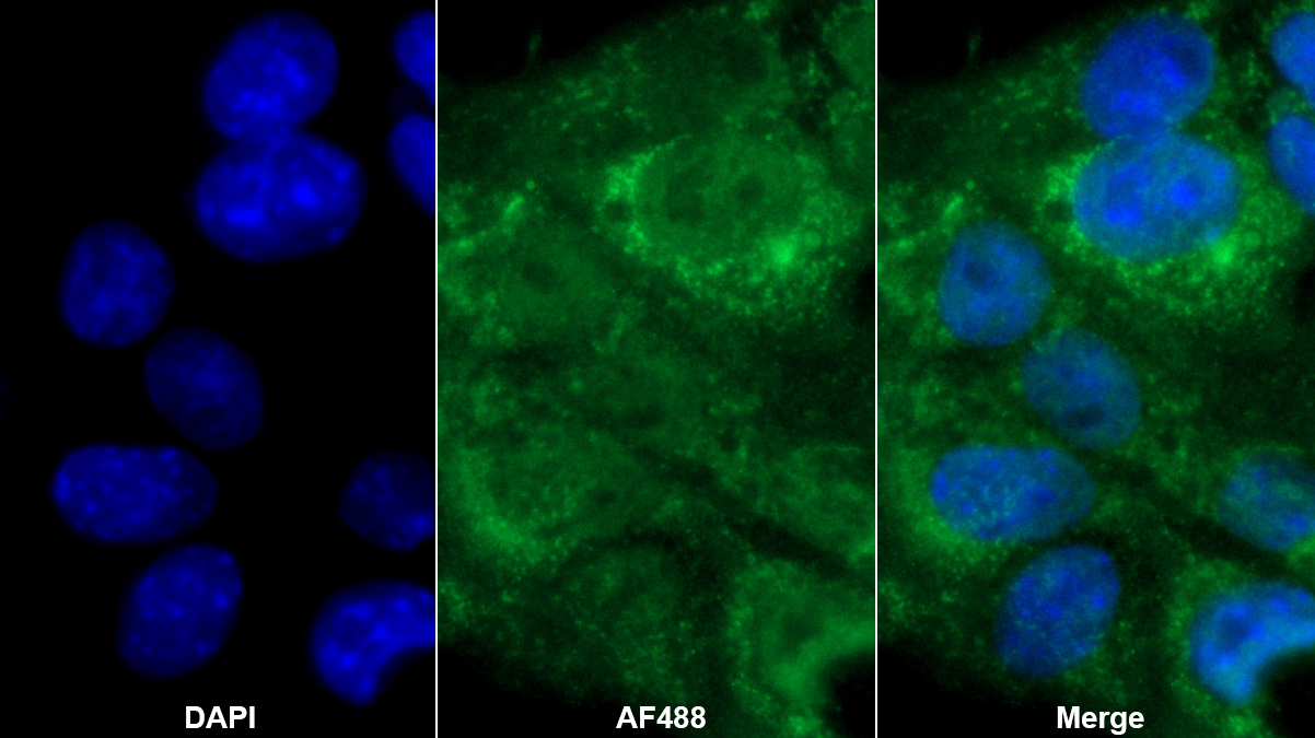 丙酮酸脫氫酶復(fù)合體成分X(PDHX)多克隆抗體