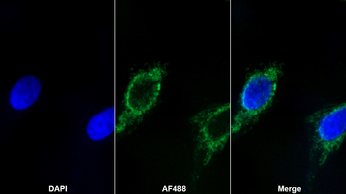 3-琥珀酰輔酶A轉(zhuǎn)移酶1(OXCT1)多克隆抗體