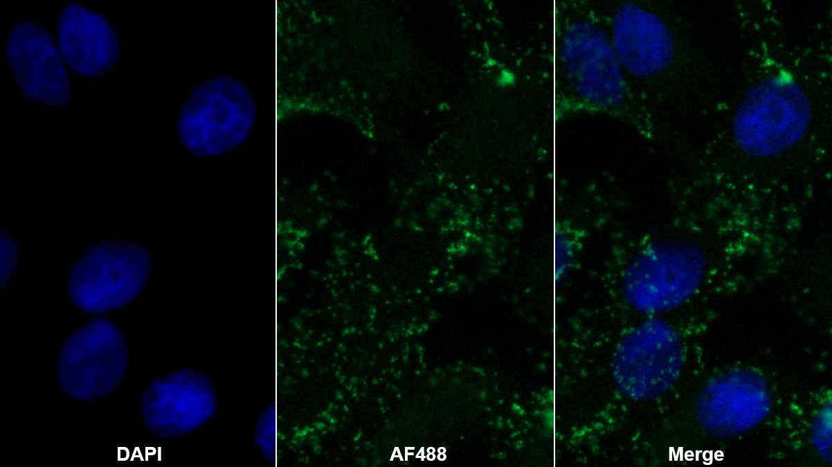间皮素(MSLN)多克隆抗体