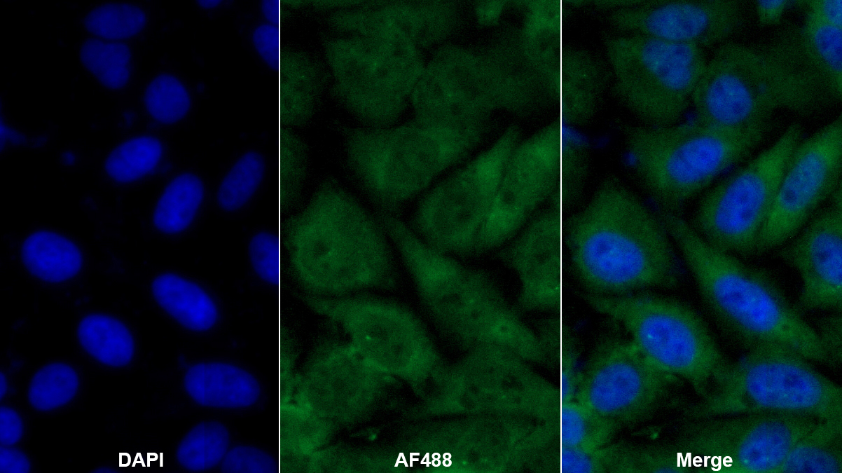 眼小畸形關(guān)聯(lián)轉(zhuǎn)錄因子(MITF)多克隆抗體