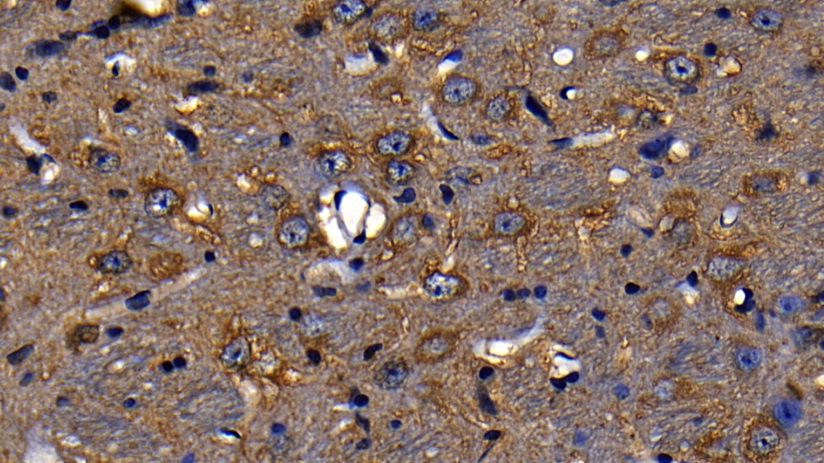 淋巴細(xì)胞抗原96(LY96)多克隆抗體