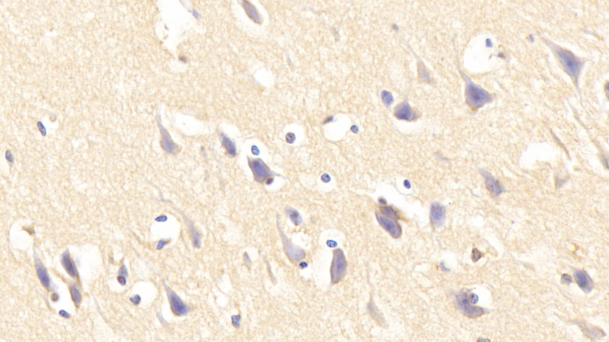 白介素1受体样蛋白1(IL1RL1)多克隆抗体