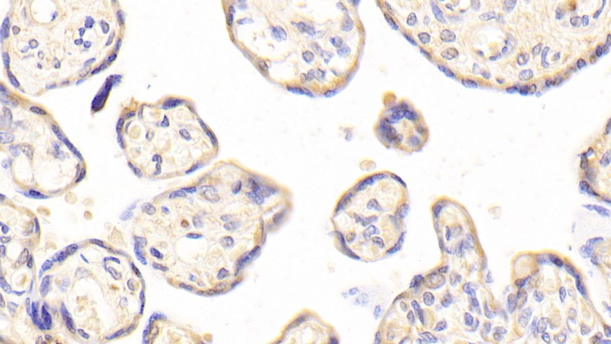 白介素1受体样蛋白1(IL1RL1)多克隆抗体