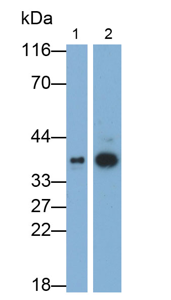 白介素1受体样蛋白1(IL1RL1)多克隆抗体