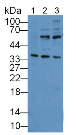 白介素1受體樣蛋白1(IL1RL1)多克隆抗體