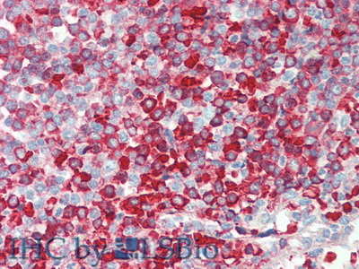 白介素1受體樣蛋白1(IL1RL1)多克隆抗體