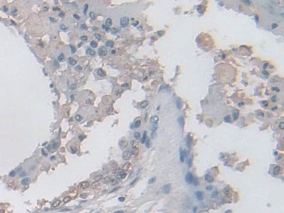 异柠檬酸脱氢酶2(IDH2)多克隆抗体