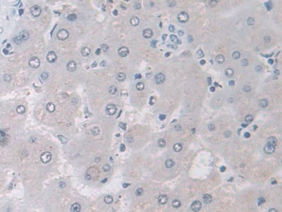 异柠檬酸脱氢酶2(IDH2)多克隆抗体