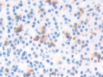 T-框蛋白3(TBX3)多克隆抗體