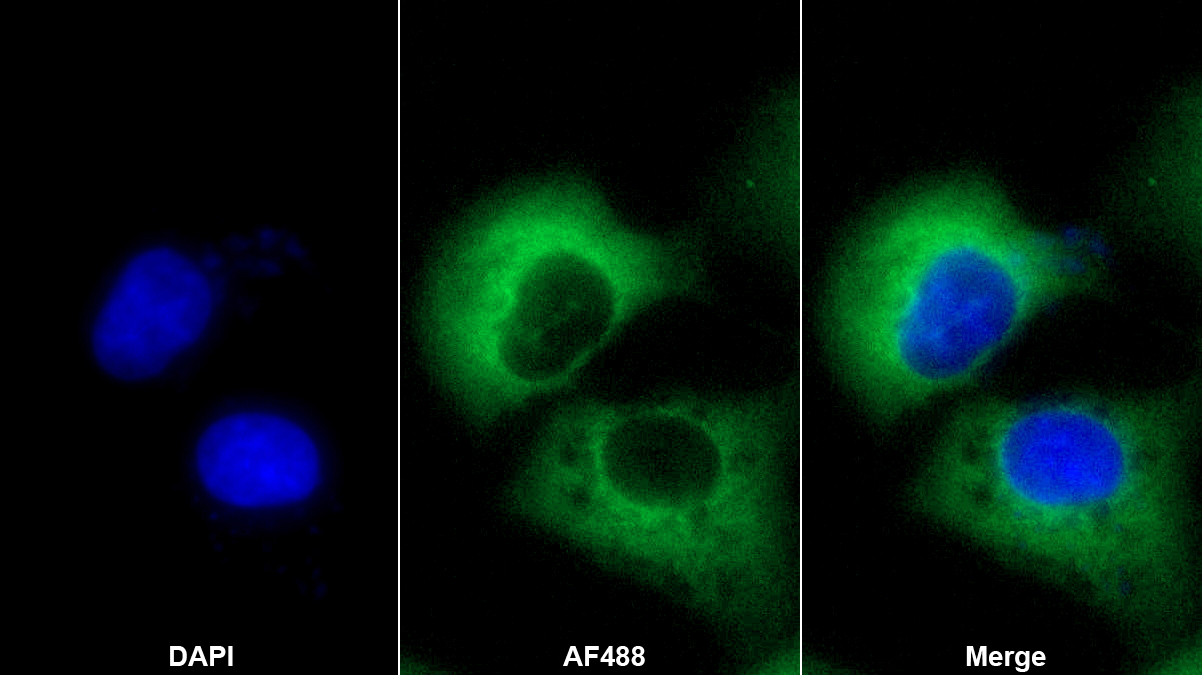 Hornerin蛋白(HRNR)多克隆抗體