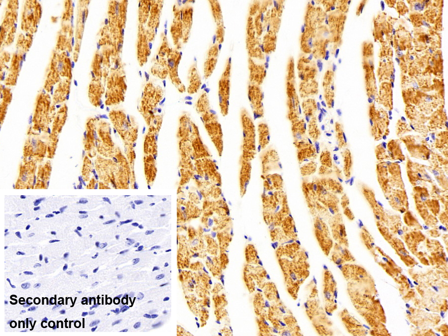 乙型肝炎病毒X相互作用蛋白(HBXIP)多克隆抗体