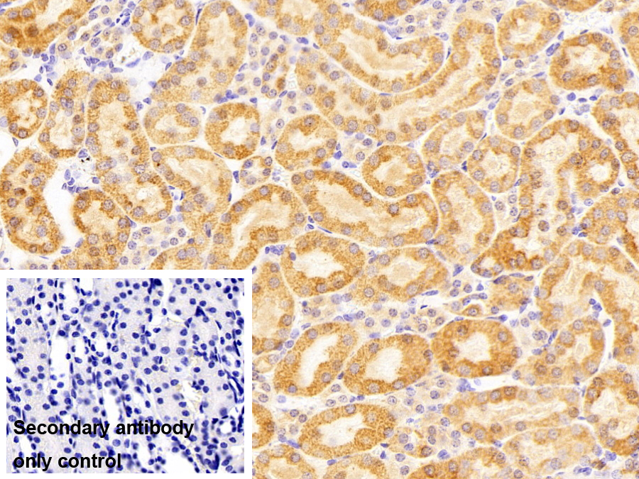 乙型肝炎病毒X相互作用蛋白(HBXIP)多克隆抗体