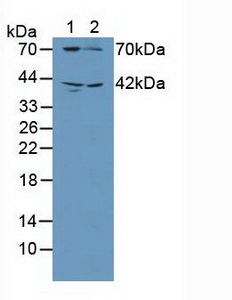 鸟苷酸环化酶1β3(GUCY1b3)多克隆抗体