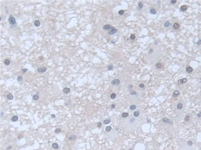 鸟苷酸环化酶1β3(GUCY1b3)多克隆抗体