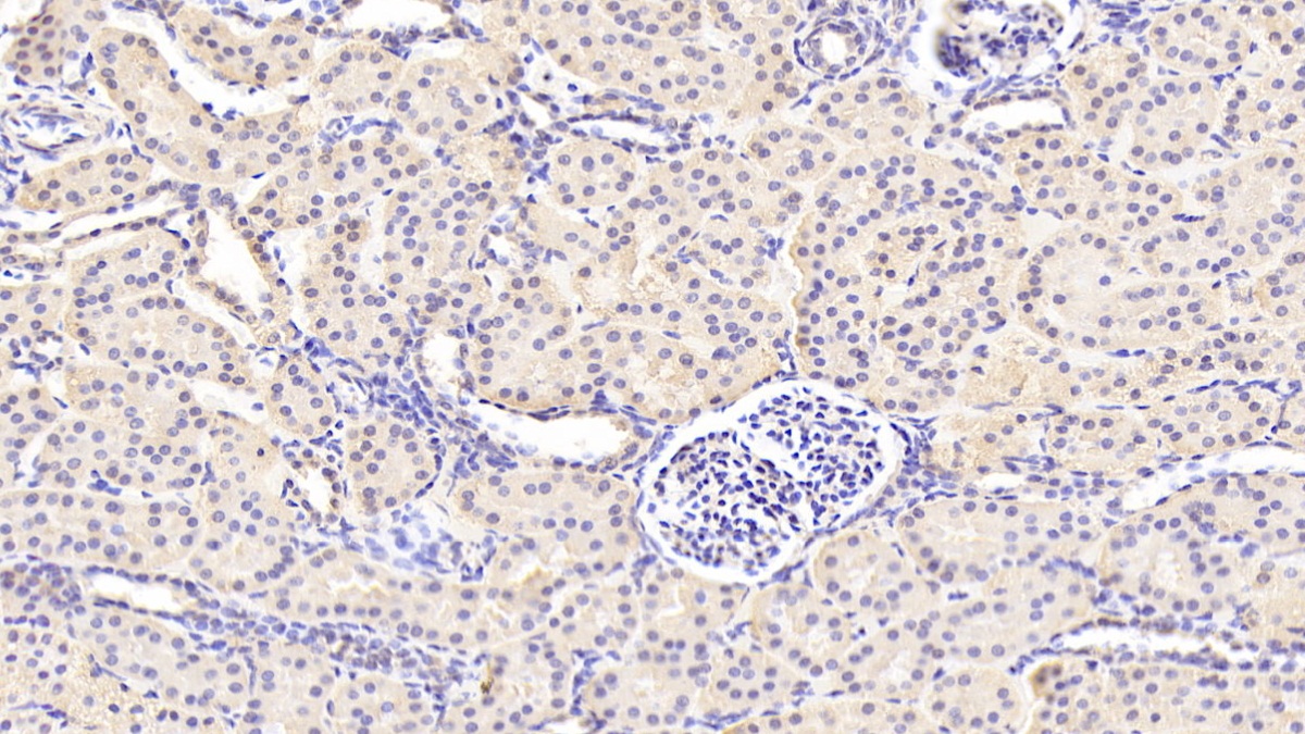 鸟苷酸环化酶1β3(GUCY1b3)多克隆抗体