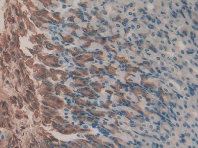 胃動(dòng)蛋白2(GKN2)多克隆抗體