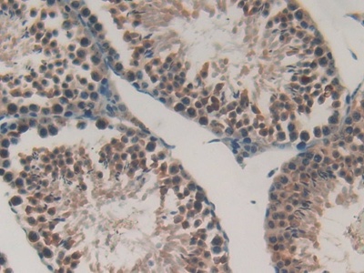 胃動(dòng)蛋白2(GKN2)多克隆抗體