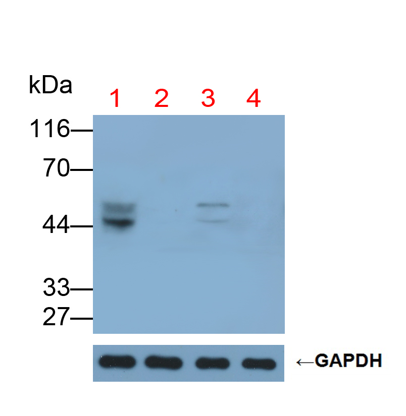 半乳糖-3-O-磺基转移酶1(GAL3ST1)多克隆抗体