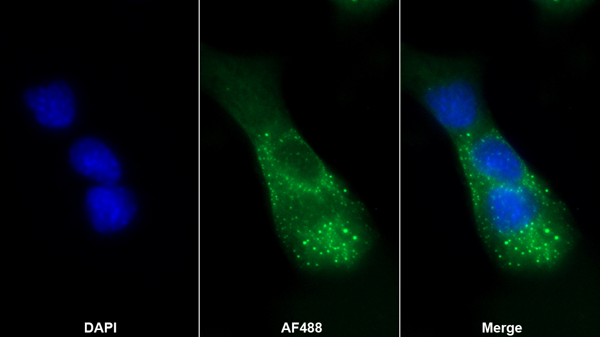 雙糖鏈蛋白聚糖(BGN)多克隆抗體