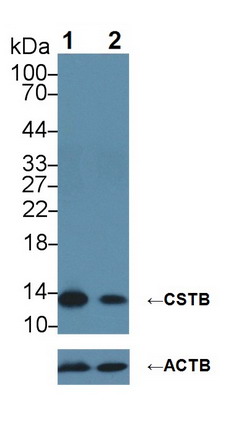 半胱氨酸蛋白酶抑制劑B(CSTB)多克隆抗體