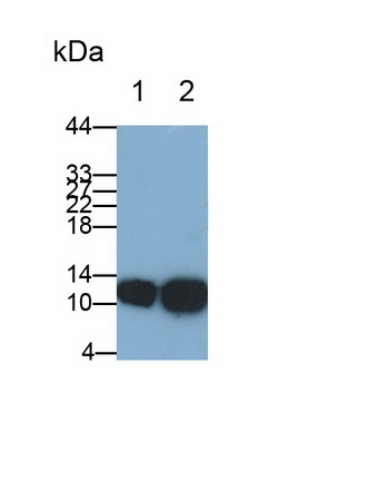半胱氨酸蛋白酶抑制劑B(CSTB)多克隆抗體