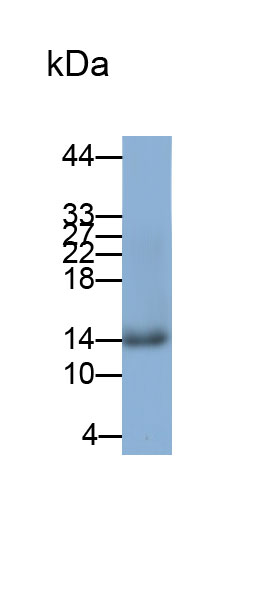 半胱氨酸蛋白酶抑制剂B(CSTB)多克隆抗体