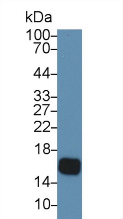 半胱氨酸蛋白酶抑制剂5(CST5)多克隆抗体