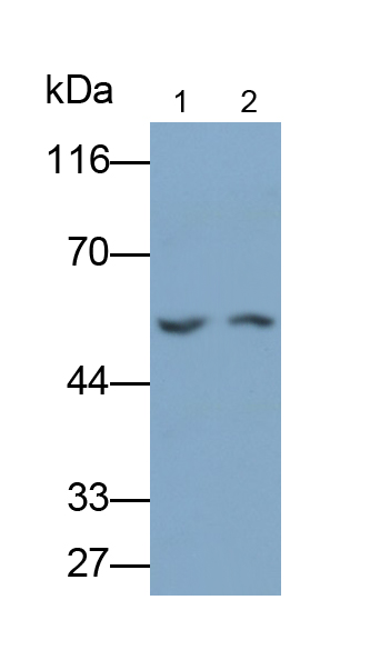 卵磷脂膽固醇脂酰轉(zhuǎn)移酶(LCAT)多克隆抗體