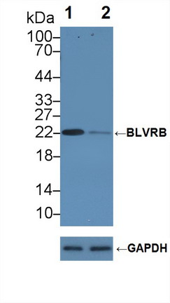 胆绿素还原酶B(BLVRB)多克隆抗体