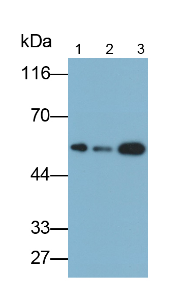 腦富含膜附著信號蛋白1(BASP1)多克隆抗體