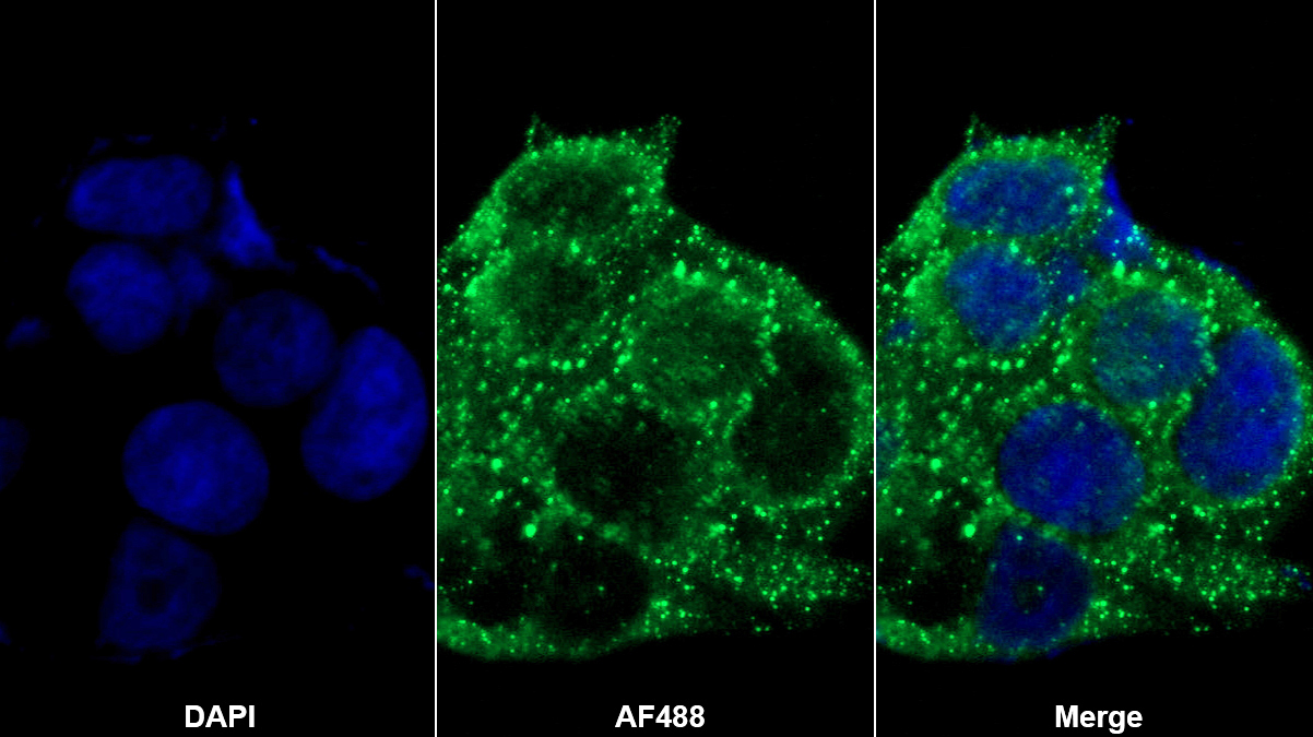 转位因子蛋白(TSPO)多克隆抗体