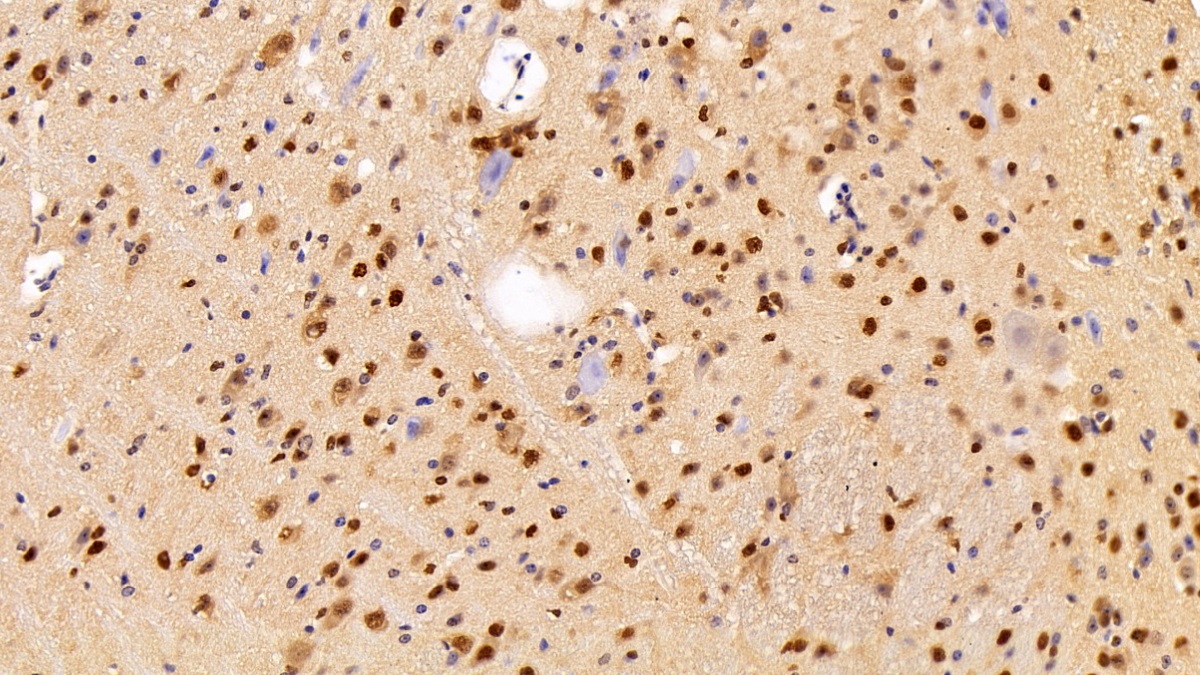 酸性核磷蛋白32A(ANP32A)多克隆抗體