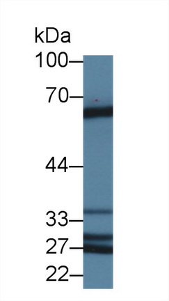 Abl交互子1(ABI1)多克隆抗体