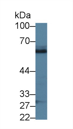 Abl交互子1(ABI1)多克隆抗体