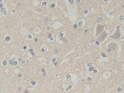 Abl交互子1(ABI1)多克隆抗体