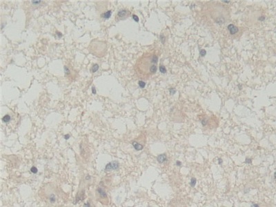 Abl交互子1(ABI1)多克隆抗体