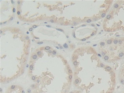 Abl交互子1(ABI1)多克隆抗体