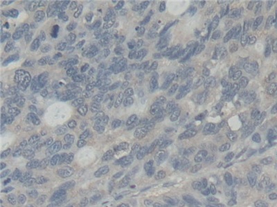 Abl交互子1(ABI1)多克隆抗体