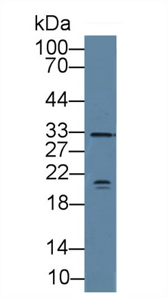 视网膜血管瘤肿瘤抑制因子(vHL)多克隆抗体