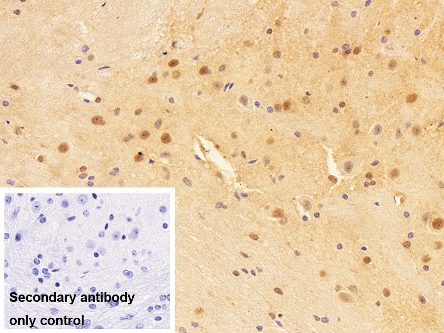 HLA-B關(guān)聯(lián)轉(zhuǎn)錄因子1(BAT1)多克隆抗體