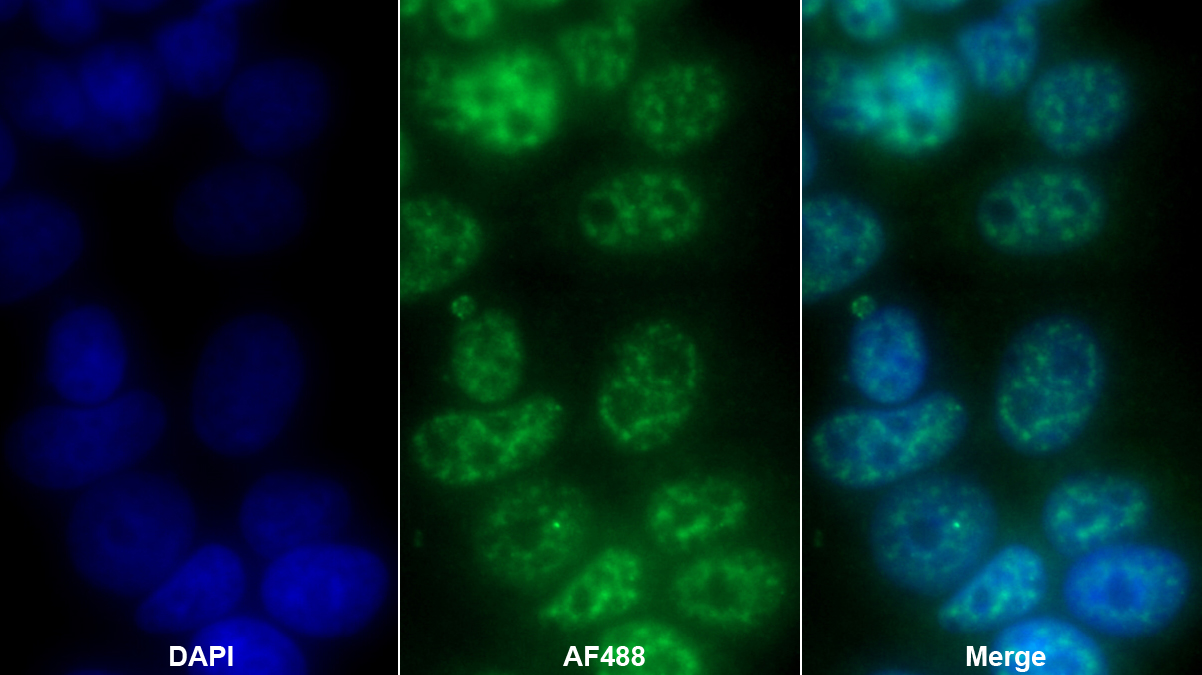 HLA-B關(guān)聯(lián)轉(zhuǎn)錄因子1(BAT1)多克隆抗體