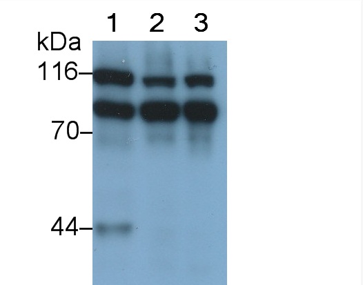 Zeste同源物增强子2(EZH2)多克隆抗体