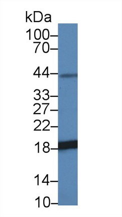 非转移细胞3表达NM23A蛋白(NME3)多克隆抗体