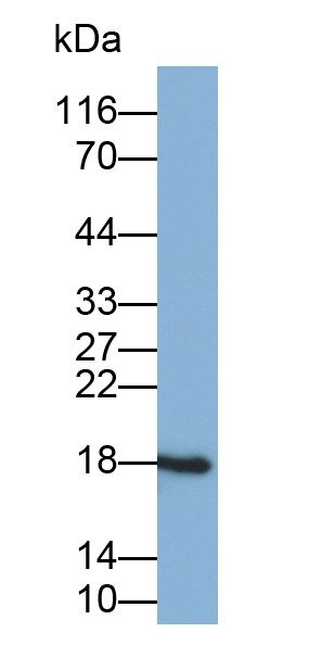 非转移细胞3表达NM23A蛋白(NME3)多克隆抗体