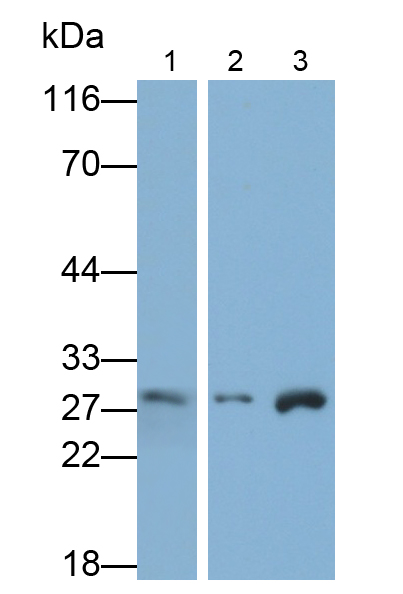 蛋白酶體亞基β10(PSMb10)多克隆抗體
