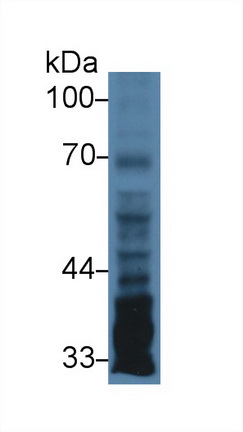 正五聚蛋白3(PTX3)多克隆抗體