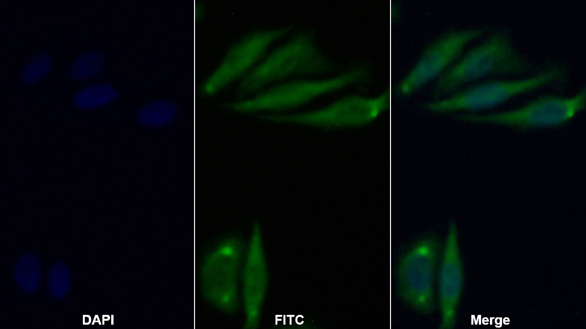 正五聚蛋白3(PTX3)多克隆抗體