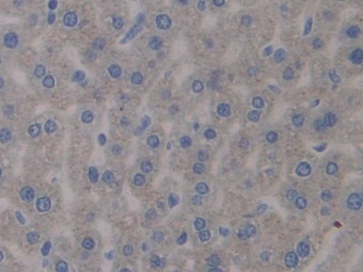 正五聚蛋白3(PTX3)多克隆抗體