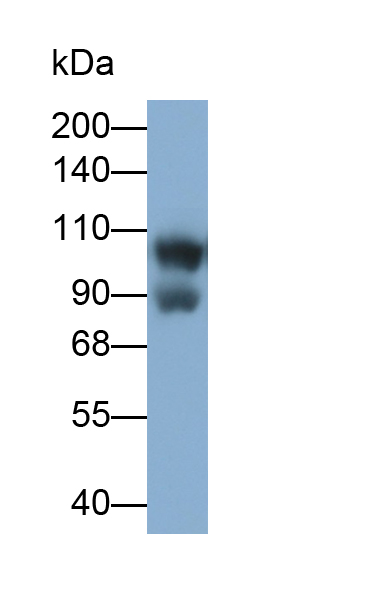 GRB2關聯結合蛋白1(GAB1)多克隆抗體