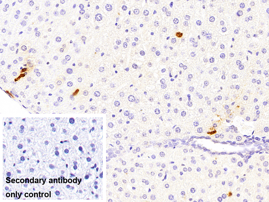 鈣衛(wèi)蛋白(CALPRO)多克隆抗體